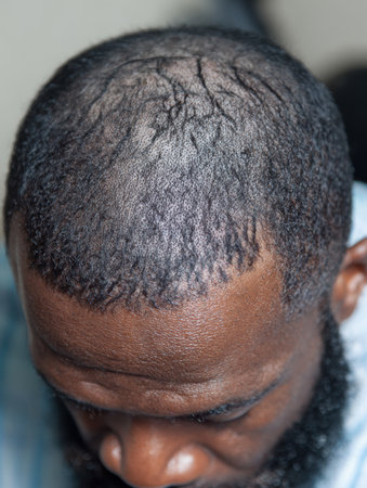 A man sits indoors, showcasing a thinning hairline and short beard, captured in soft lighting that highlights the details of his scalp.の素材