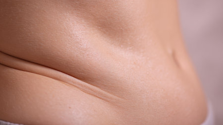 Close-up view of belly skin revealing dimples, cellulite, and stretch marks in a clinical and detailed macro style.の素材