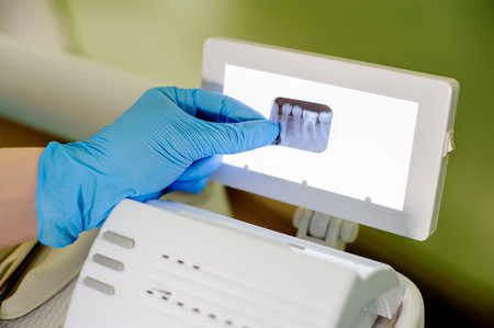 Dentist holding X-ray in stomatology office, focus on X-ray. Teeth care and tooth health. Stomatology equipmentの写真素材