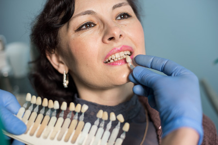 Close-up portrait of woman in dental clinic office. Dentist checking and selecting colour of the...