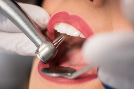 Dentist teating a patient's teeth with dental tools - mirror and drill with water spray in dental...