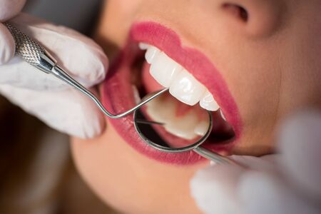 Close up of young woman having dental check up in dental office. Dentist examining a patient's teeth...