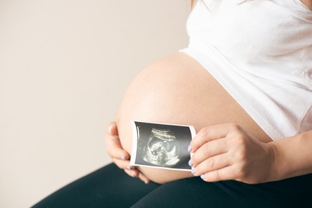 Side view of pregnant woman in white shirt sitting and showing ultrasound image of baby. Future young mother expecting child. Concept of anticipation and parental love.の写真素材