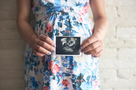 Pregnant woman with big belly in flowery dress showing ultrasound image of baby. Future young mother expecting little child. Concept of pregnancy and scan.の写真素材