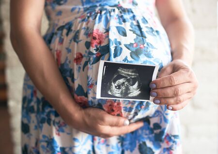 Pregnant woman in flowery dress showing ultrasound image of baby. Future young mother holding big belly with hand and expecting little infant. Concept of pregnancy and scan.の写真素材