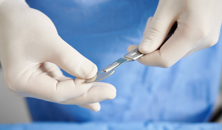 Close up view of doctors hands getting ready scalpel for plastic surgery. Surgeon with stainless...