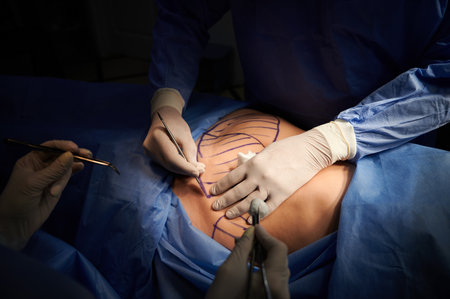 Close up of plastic surgeon hands in gloves using scalpel while doing plastic surgery in clinic. Patient with marks on belly lying on operating table. Concept of cosmetic surgery and abdominoplasty.の写真素材