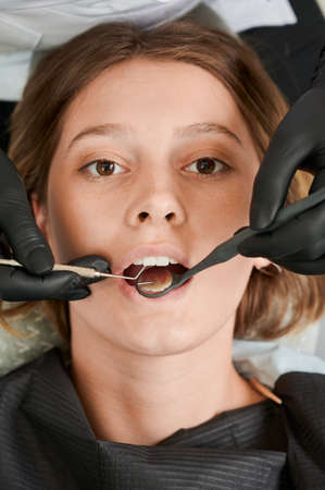 Close up of dentist hands checking female patient teeth with dental mirror and explorer. Young woman having prophylactic examination in dental clinic. Concept of dentistry, dental care. Vertical shot.の写真素材