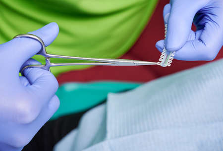 Orthodontist hands cutting elastic ligature ties with dental scissors.の写真素材