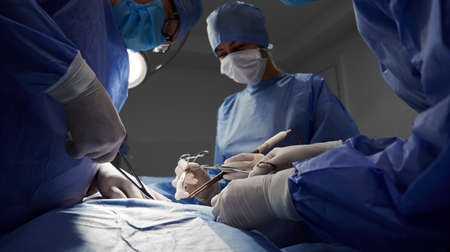 Surgical team in blue medical suits using medical instruments and performing surgical operation. Focus on surgeon hands doing cosmetic surgery at hostpital. Concept of medicine and plastic surgery.の写真素材