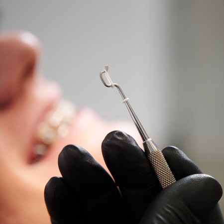 Marco snapshot of steel dental tool held by dentists hands in black latex glove. White rubber band for braces is on tool. Selective focus. Mans smile in on blurred backgroundの写真素材