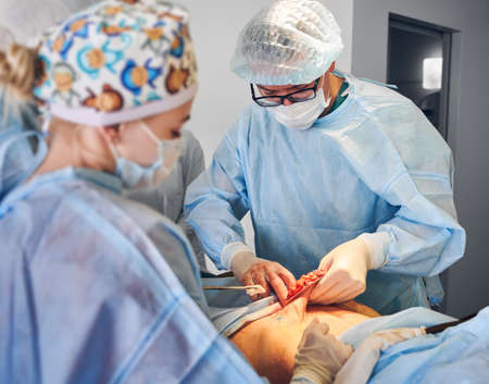 Plastic surgeon and assistant performing plastic surgery in operating room, wearing medical face masks and surgical uniforms while removing excess fat from patient abdomen. Concept of abdominoplasty.の写真素材