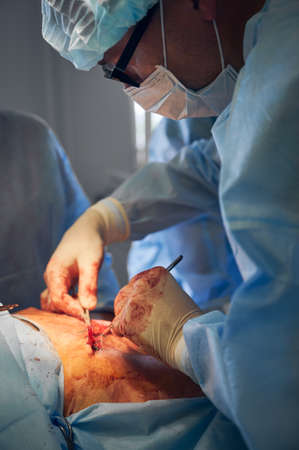 Male plastic surgeon in sterile gloves doing plastical surgical operation in hospital. Doctor performing abdominal plastic surgery in clinic. Concept of abdominoplasty and cosmetic surgery.の写真素材