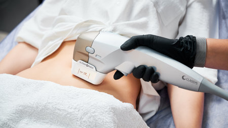 Kyiv, Ukraine - December 26, 2020: Close up doctor cosmetologist using ultrasound device Ultraformer while performing lifting procedure on woman abdomen.のeditorial素材