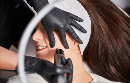 Top view of happy smiling woman having face lifting beauty procedure in cosmetology clinic. Cosmetologist using radiofrequency microneedling device while performing rejuvenation facial treatment.の写真素材