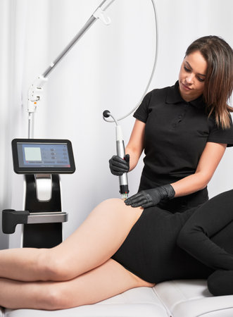 Doctor beautician using radiofrequency microneedling device while performing skin tightening treatment on female hip. Woman lying near cosmetology equipment and having stretch marks removal procedureの写真素材