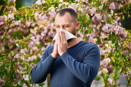 Man allergic suffering from seasonal allergy at spring in blossoming garden at springtime. Man sneezing and blowing nose using nasal handkerchief in front of blooming tree. Spring allergy concept.の写真素材