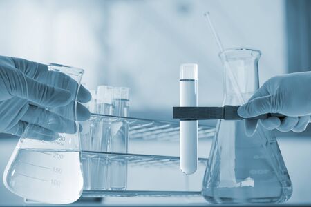 Flask in scientist hand with dropping chemical liquid to test tubes, science and medical research...