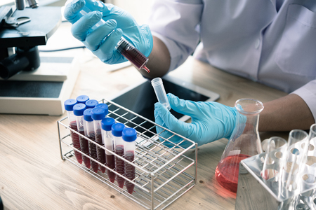 technician of health with blood tubes in the clinical lab for analytical , Medical, pharmaceutical and scientific research and development concept.の写真素材