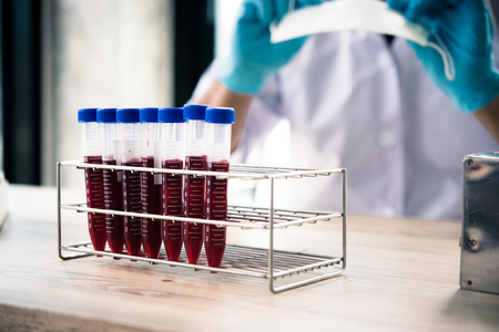 technician of health with blood tubes in the clinical lab for analytical , Medical, pharmaceutical and scientific research and development concept.の写真素材