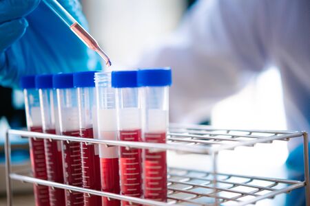 technician of health with blood tubes in the clinical lab for analytical , Medical, pharmaceutical and scientific research and development concept.の写真素材