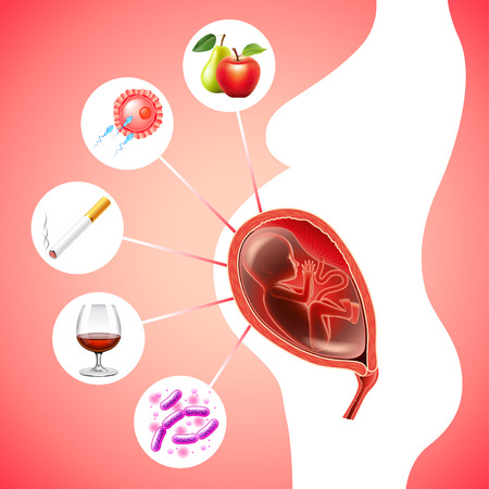 Silhouette of pregnant woman and different factors in circles on red background vectorのイラスト素材