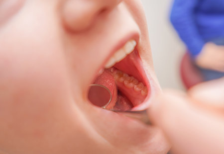 A dentist examines the teeth in the mouth of a girl.の写真素材