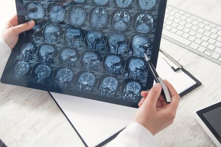 Doctor looking at xray picture of head.