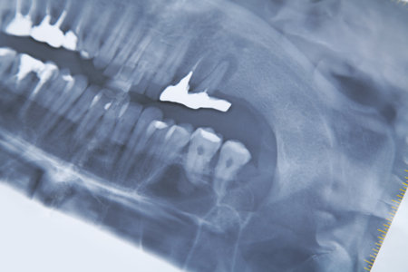 Teeth x-ray image. Scan of teeth