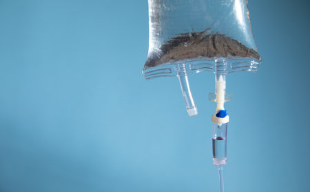 Infusion bag in the blue background. IV drip chamberの写真素材
