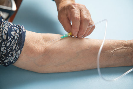 Hand of elderly patient with IV drip.の写真素材