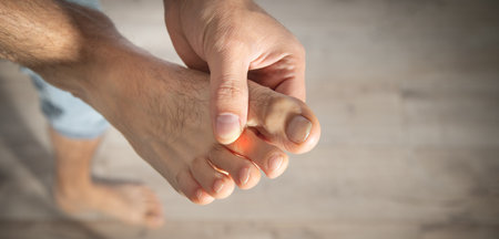 Caucasian man with pain in foot.の写真素材