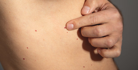 Red dots on the human body.の写真素材