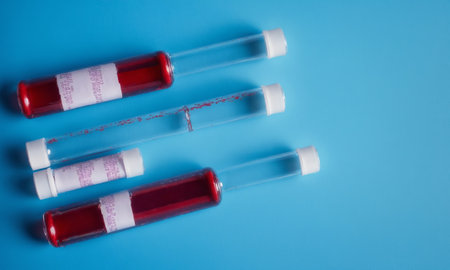 Test tubes with blood samples on a blue background. medical backgroundの素材
