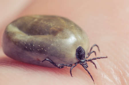 Tick filled with blood sitting on human skin.の写真素材