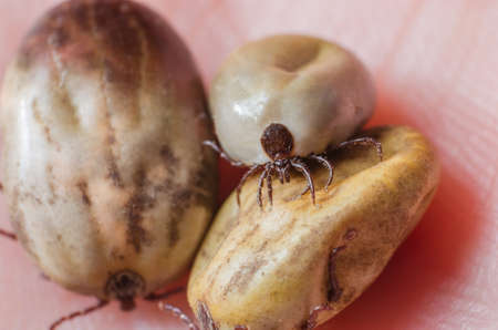 Tick filled with blood sitting on human skin.の写真素材
