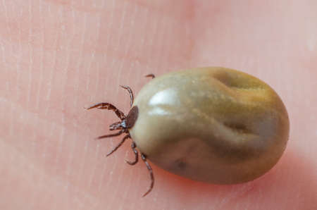 Tick filled with blood sitting on human skin.の写真素材