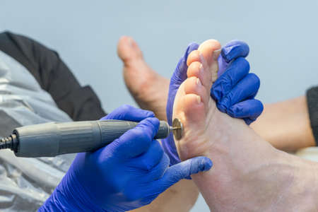 Hardware pedicure, sanding the foot with an abrasive disc.の写真素材