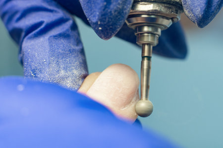 Manicure process, cleaning nails with a milling cutter close up.