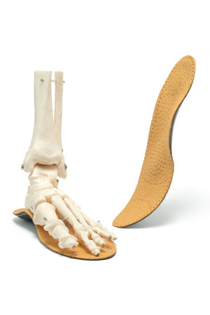 Anatomical model of human foot bones with orthopedic insole isolated on white background. Treatment...