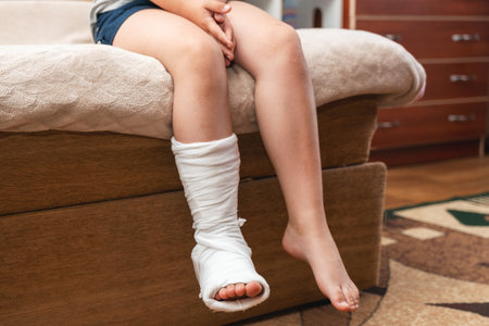 Children's legs, one leg is broken and in a cast.の写真素材