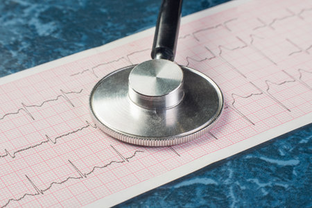 Close up of a Stethoscope on an Electrocardiogram Printout, Highlighting Heartbeat Patterns and...