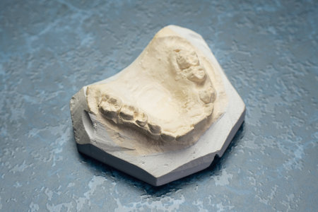 Impression of Dental Arch Model for Orthodontic Applications on Textured Surface.