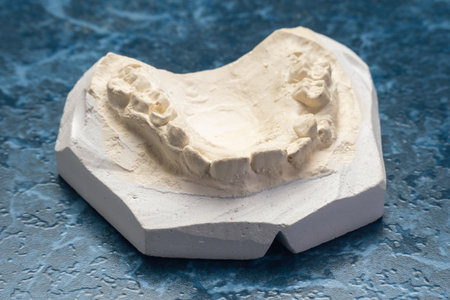 Impression of Dental Arch Model for Orthodontic Applications on Textured Surface.