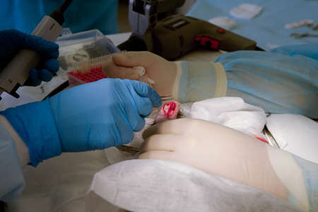 Operation on the rabbits pawの写真素材