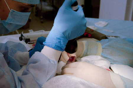 Operation on the rabbits pawの写真素材