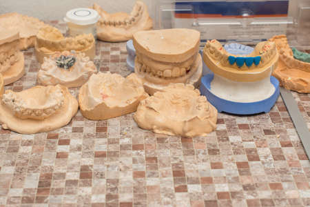 molds of of the teeth are on the table
