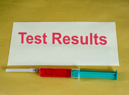 Syringe with blood sample and envelope with test resultsの写真素材