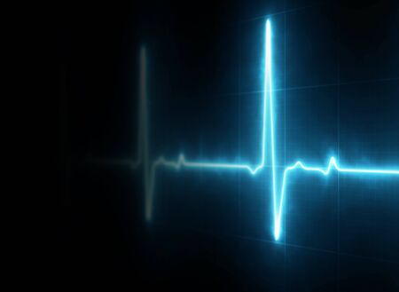 EKG Heart Line Monitor