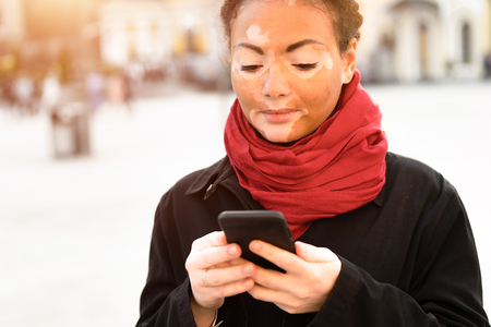 A beautiful young girl of African ethnicity with vitiligo standing on the warm spring city street using mobile phone close up portrait of woman with skin problems.の写真素材